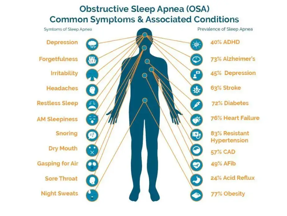 A diagram that shows Sleep apnea's (OSA) Common Symptoms and associated conditions.
