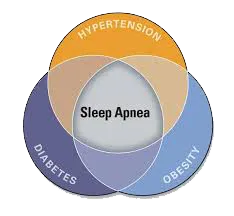 sleep-apnea-chart